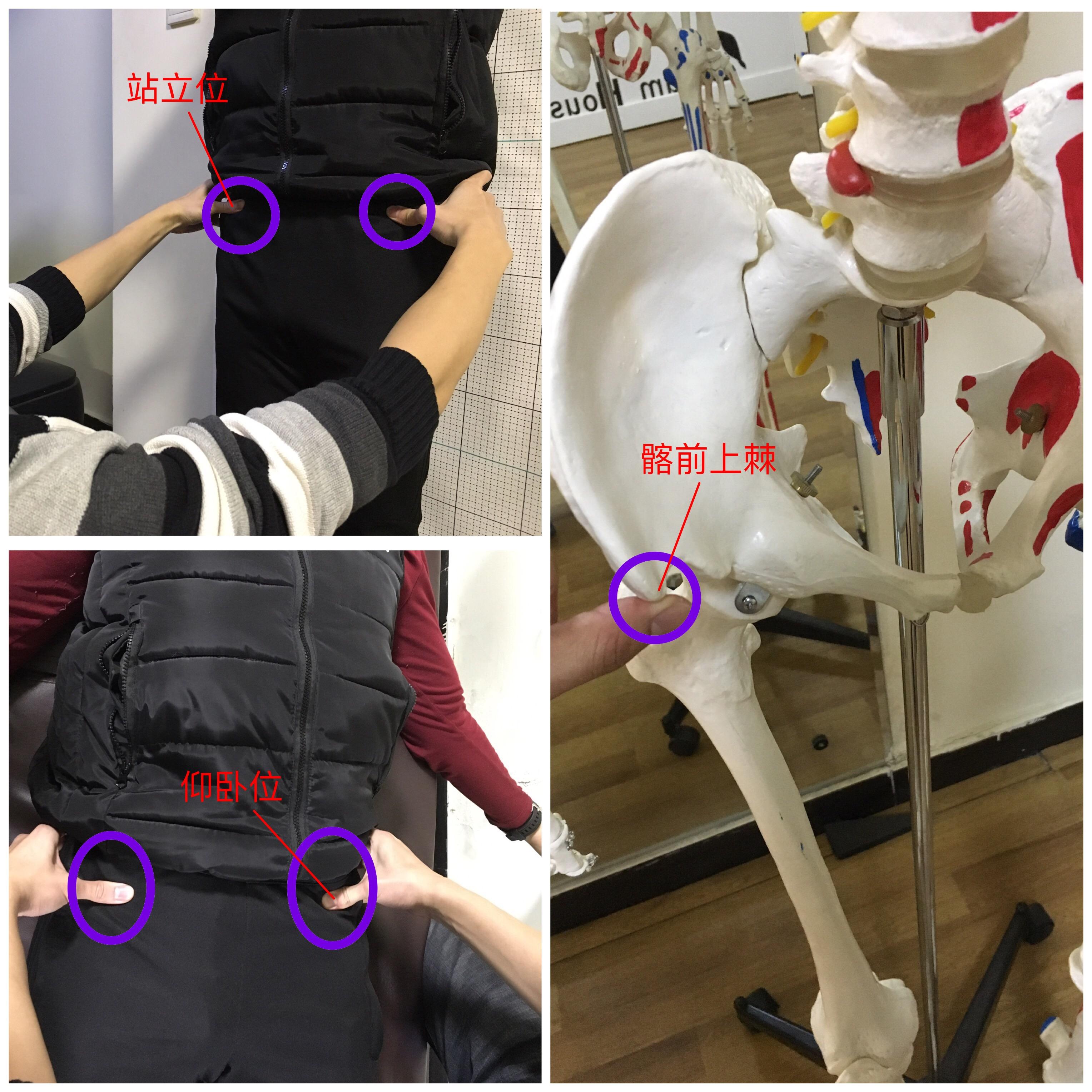 苏州客户经评估骨盆pec模式，内收肌肌力1级造成的耻骨过宽、突出 - 知乎