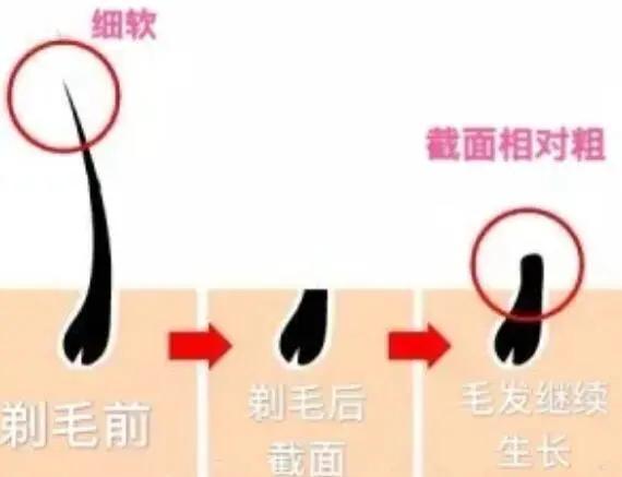 就想知道体毛是不是真的越刮越长越粗越多？ - 知乎