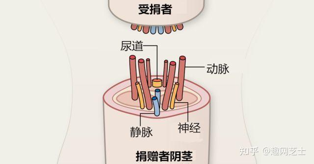 丁丁壞了如何換根新的