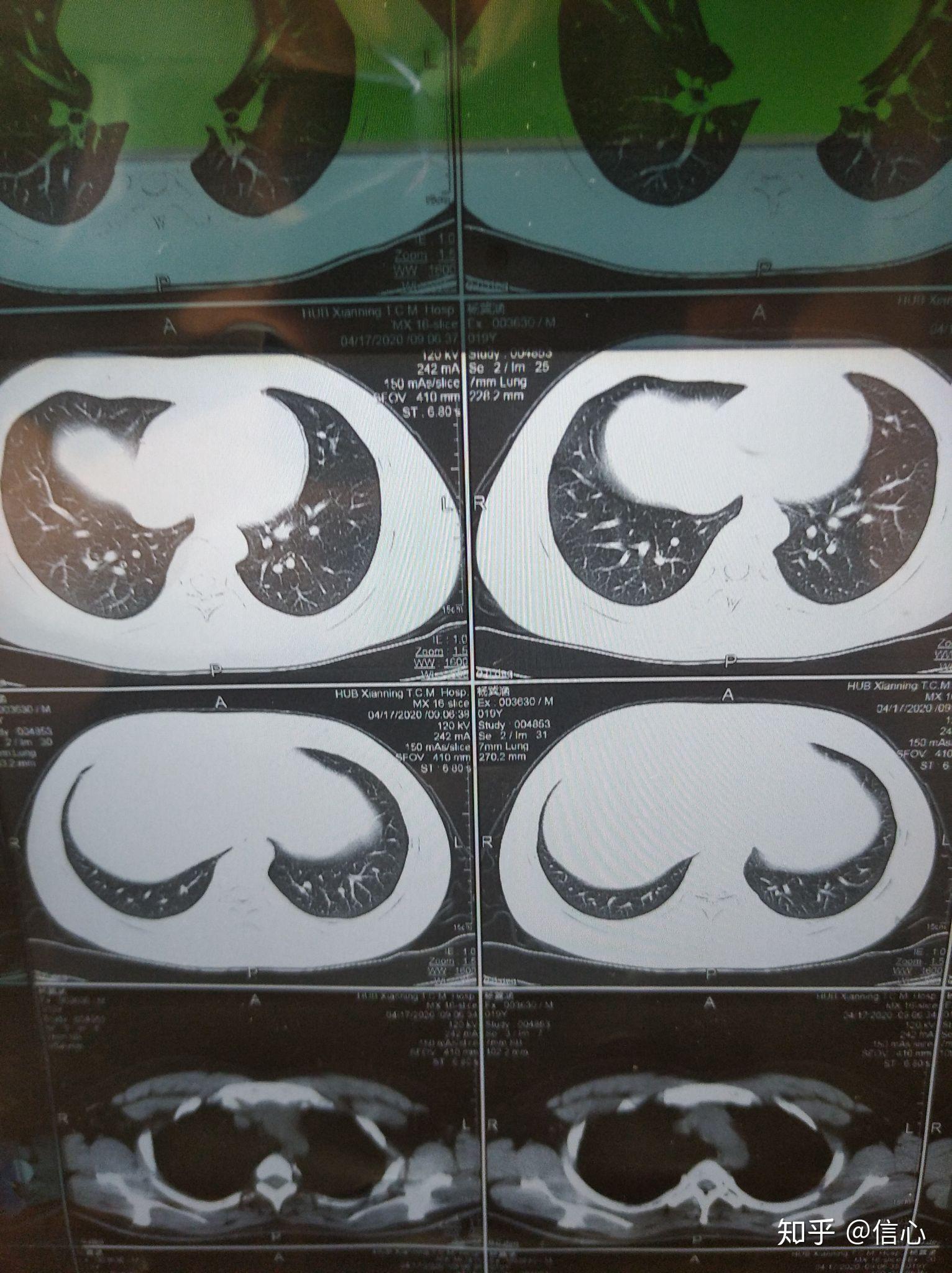 关于北京302医院、门头沟区产科建档价格——靠谱的代挂号贩子的信息