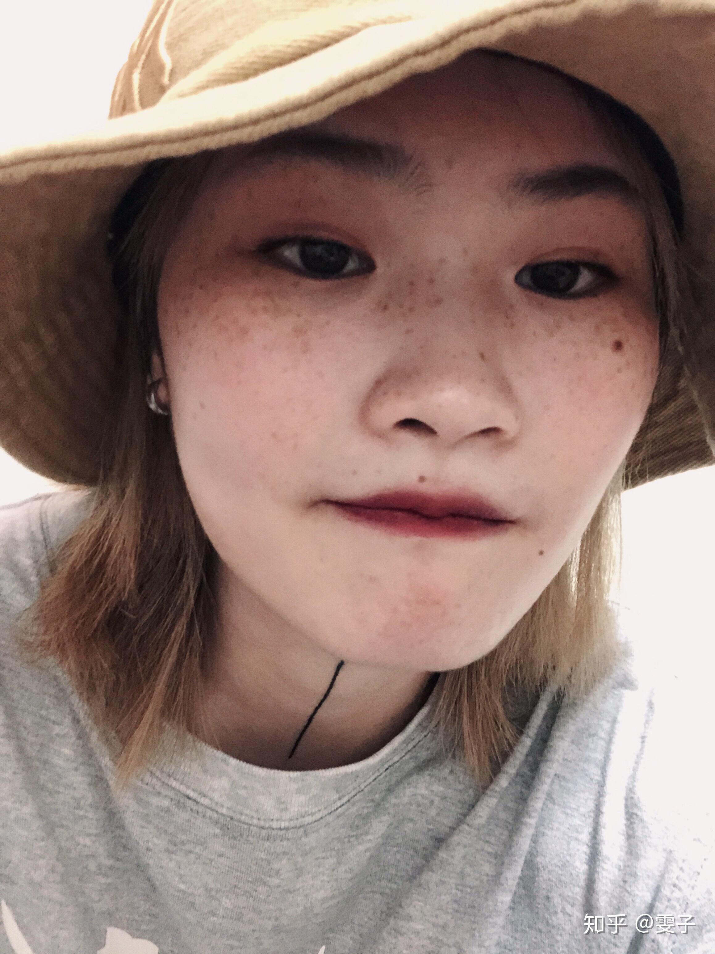 有雀斑的的女生是不是都很自卑