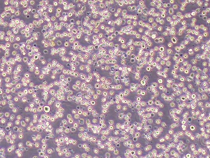 HEY A8 Cells人卵巢癌细胞种子实验室复苏 - 知乎