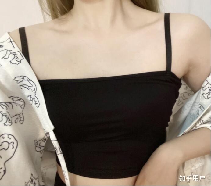 女生后背长痘痘有痘印怎么回事怎么办