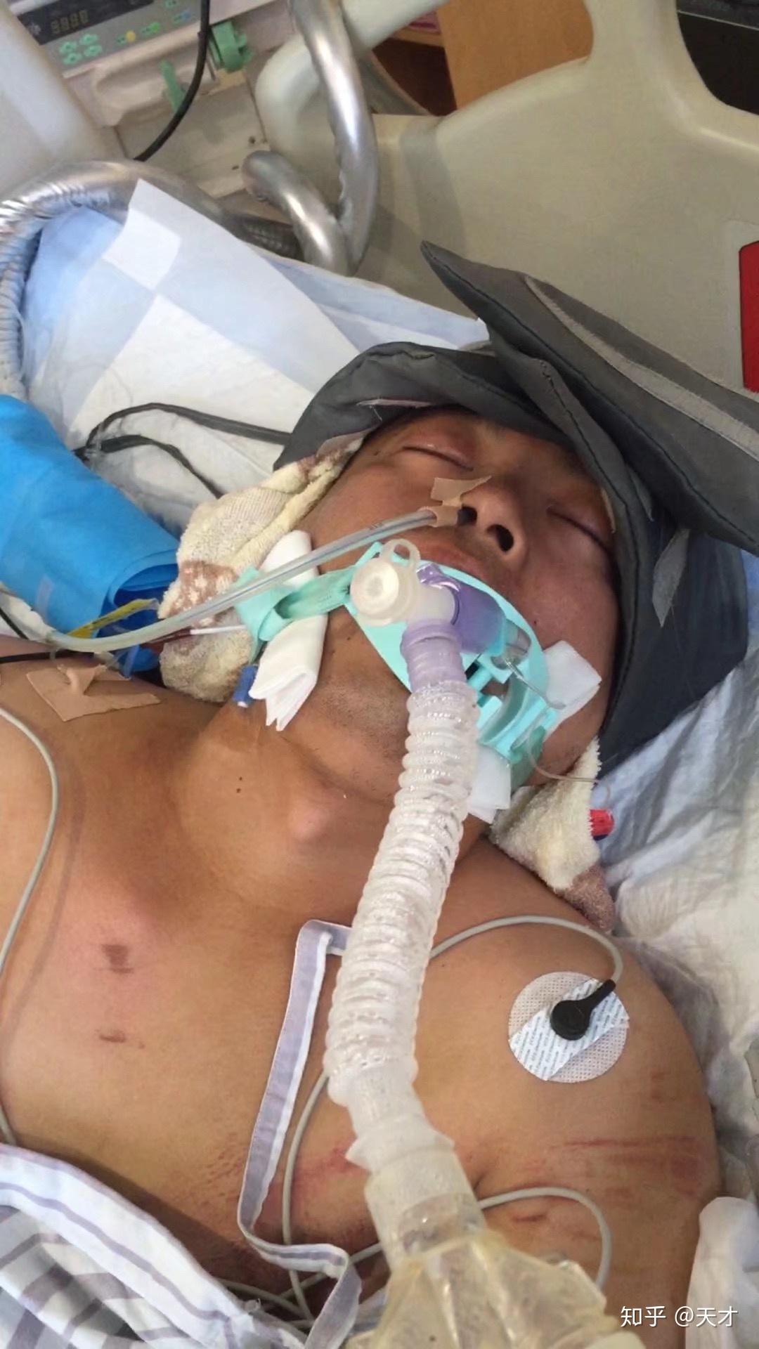 哥哥意外离世我的人生观之改变