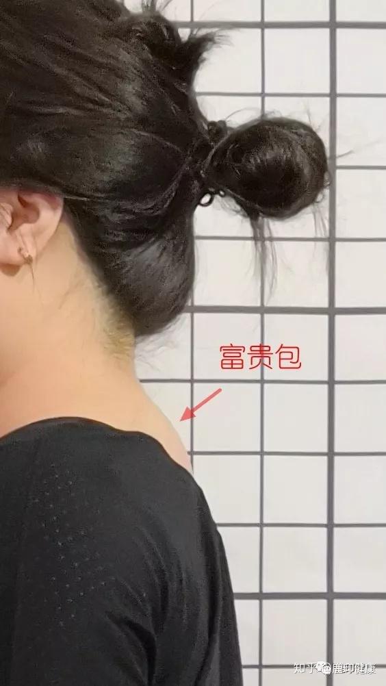 脖子后面肉多又有皱褶提示我有什么不妥了