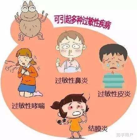 过敏性哮喘治疗
