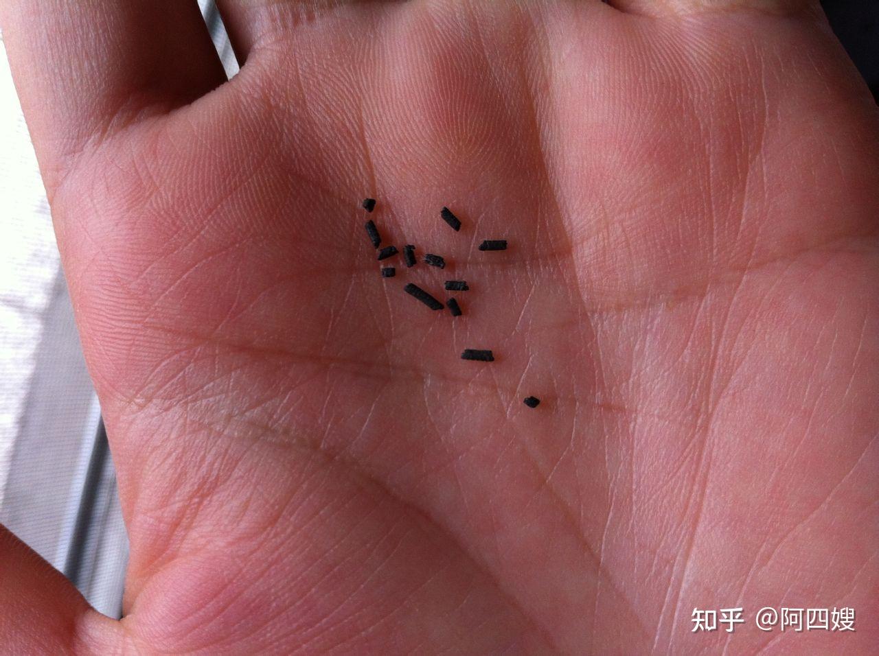 虫害防制人员教您认识蚊子的习性与分类-搜狐