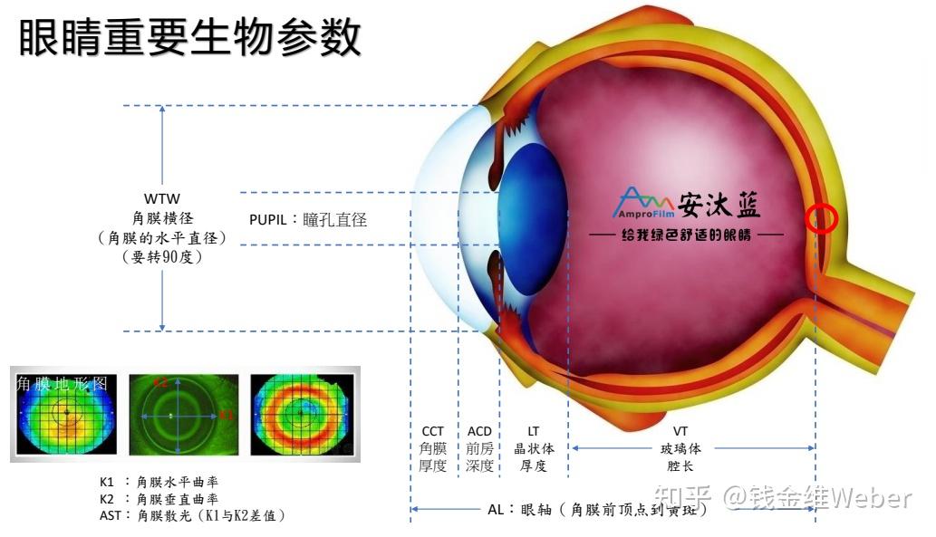 分享一個高度近視高眼壓控眼軸的歷程