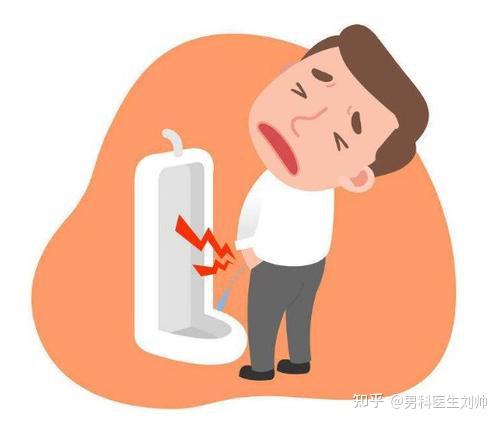 I型前列腺炎的病因、临床表现及诊断 - 知乎
