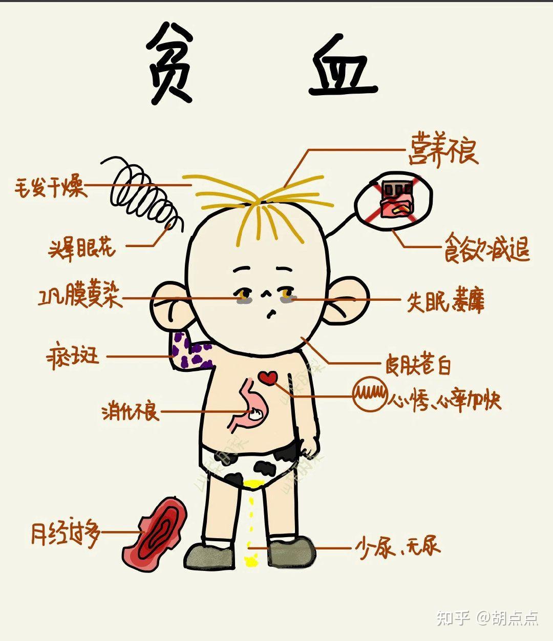 急性心衰,感染性心内膜炎,霍乱,恙虫病,肝炎,流行性乙型脑炎,贫血