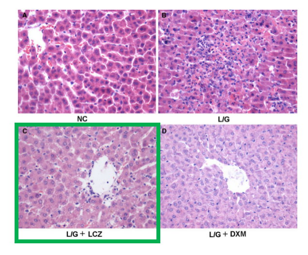 科拓研发干酪乳杆菌zhang保肝护肝新突破