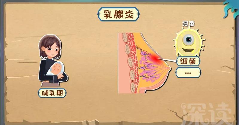 惊一半新手妈妈哺乳期患有急性乳腺炎到底多惨奶爸必看