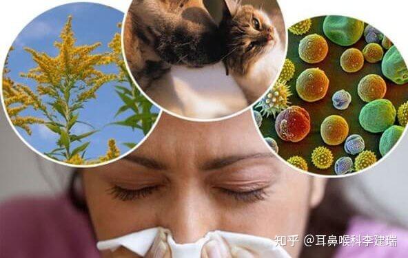 过敏性鼻炎会不会传染其实有个事情比传染更让人头疼