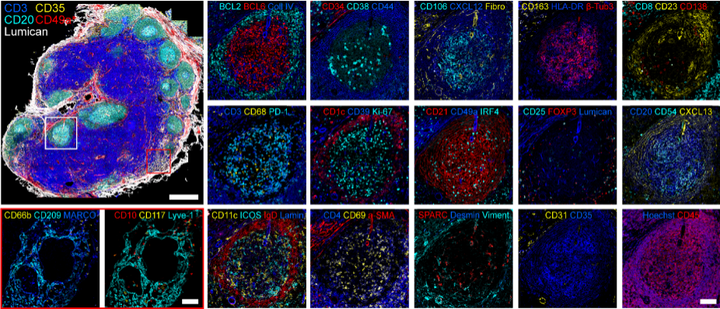 多重免疫荧光/多重免疫组化及肿瘤微环境系列1 - 知乎