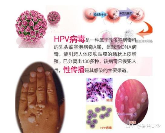 hpv是怎么传播的?