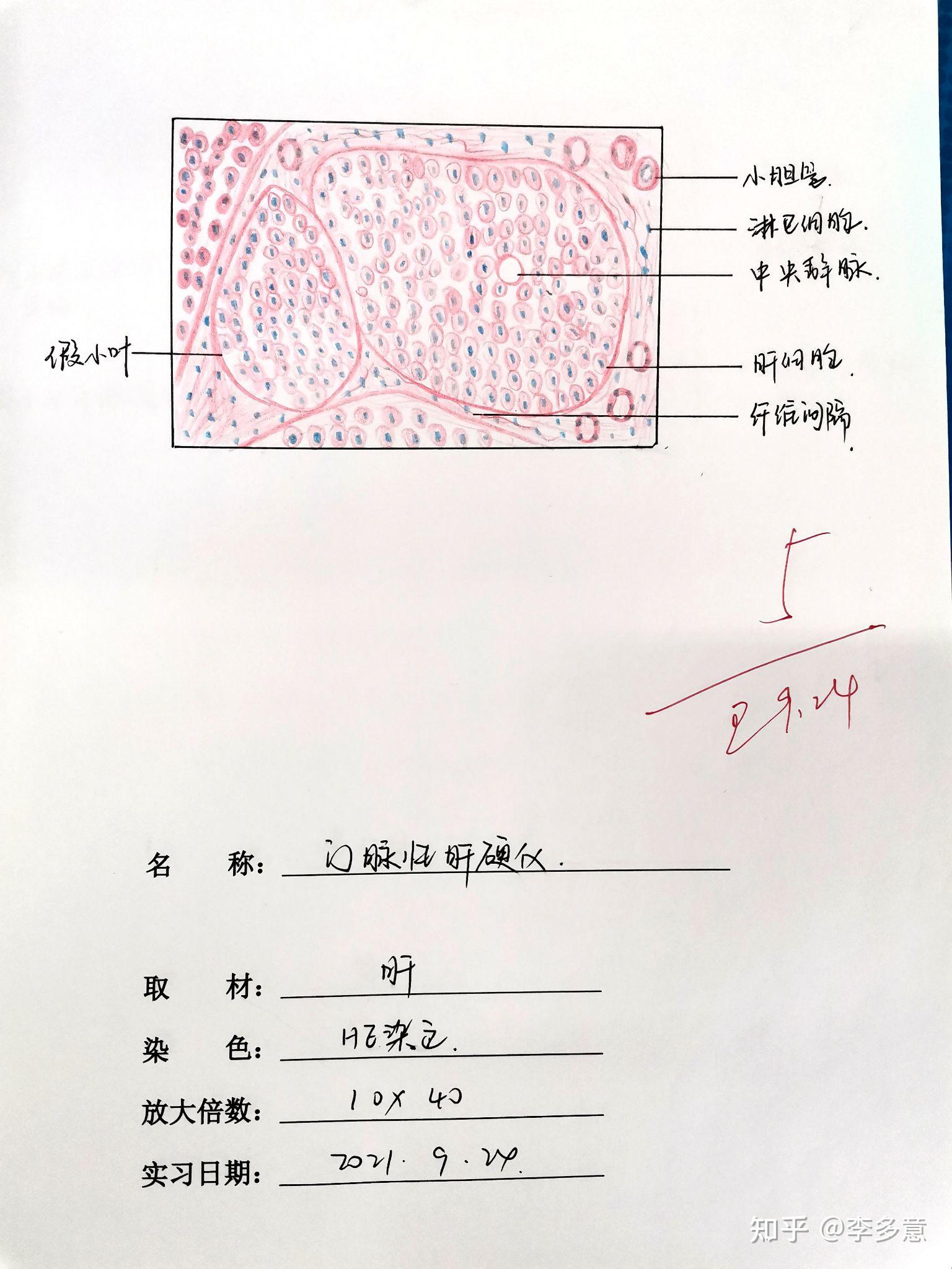 病理红蓝铅笔图存档(仅供参考) 