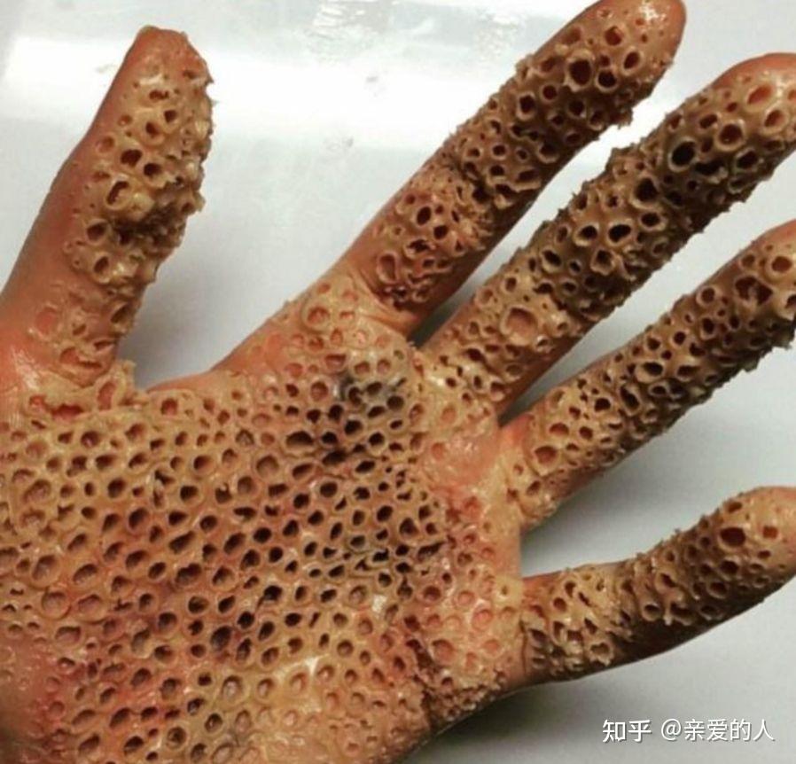 有没有那种看着就恶心的图?