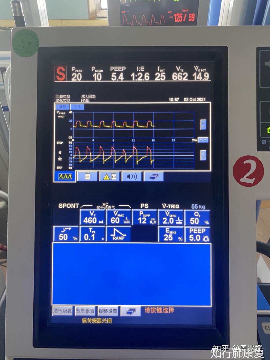 呼吸浅快指数rsbi如何预测撤机结局