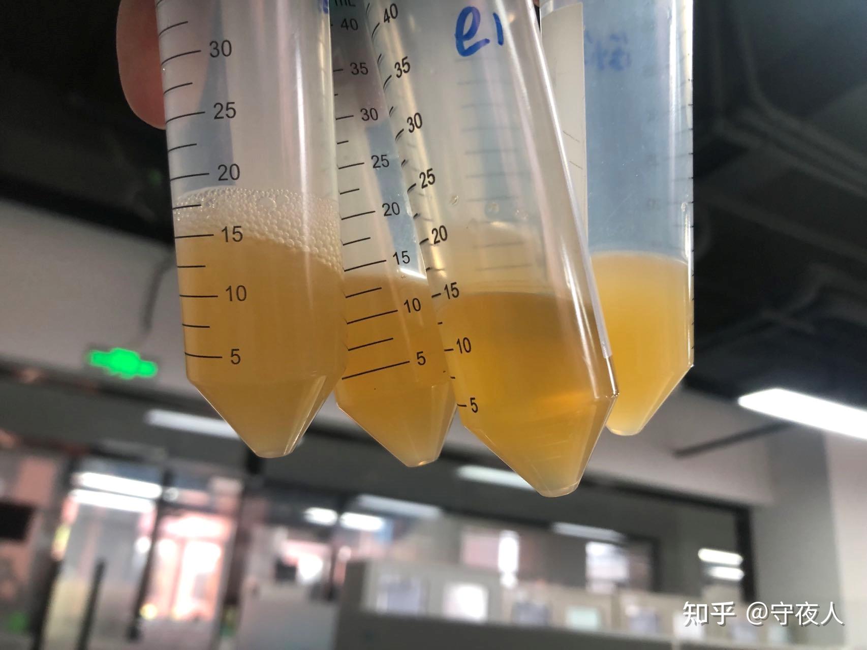 请问农杆菌摇好的标志是什么? - 知乎