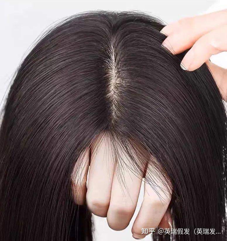 发量焦虑,你有吗? - 知乎
