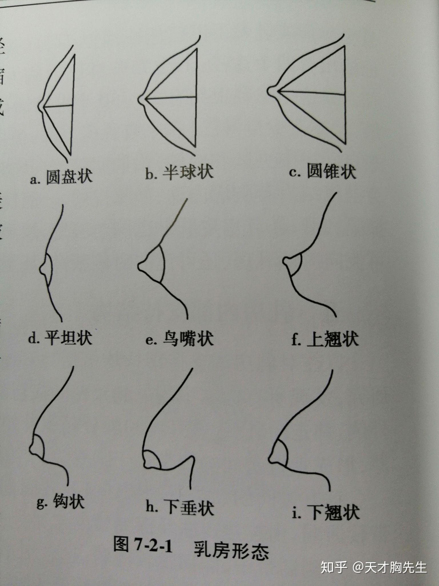 胸部美學五大金標準