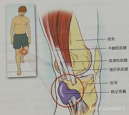 鹅足肌腱是缝匠肌,股薄肌及半腱肌的联合腱止点,位于胫骨内侧副韧带的