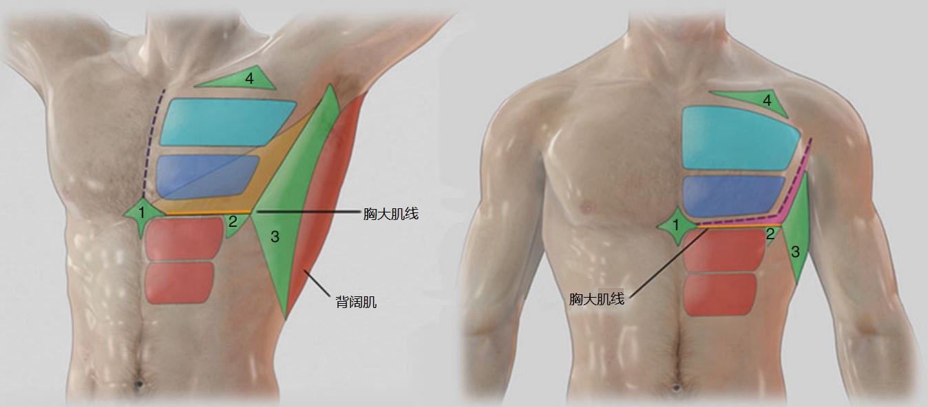 怎样判断男性乳房肥大是脂肪堆积还是乳腺发育? - 知乎