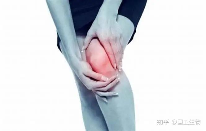 3款干细胞新药获批骨关节炎患者迎来新希望