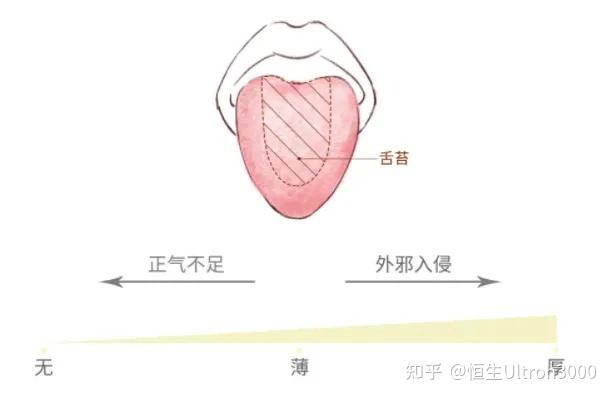 一看就懂|简单实用的舌诊图谱大全，教你快速识别疾病！ - 知乎