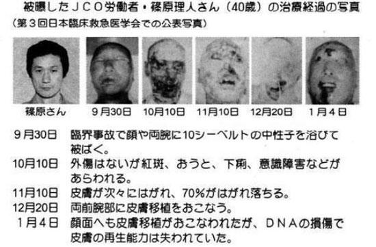 10集装箱式火箭炮奇袭因吉尔利克空军基地造成灾难性后