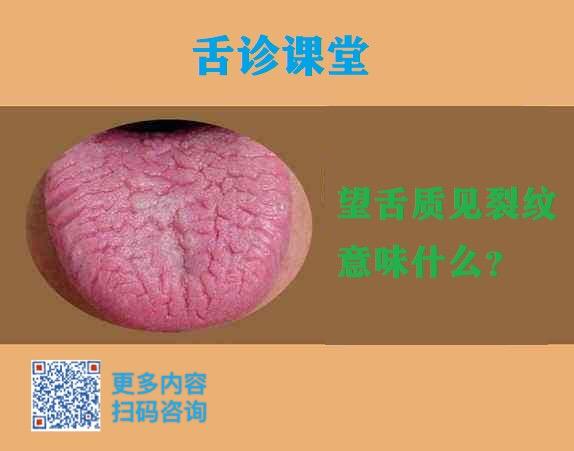 舌头有裂纹,身体可能有这些问题! - 知乎