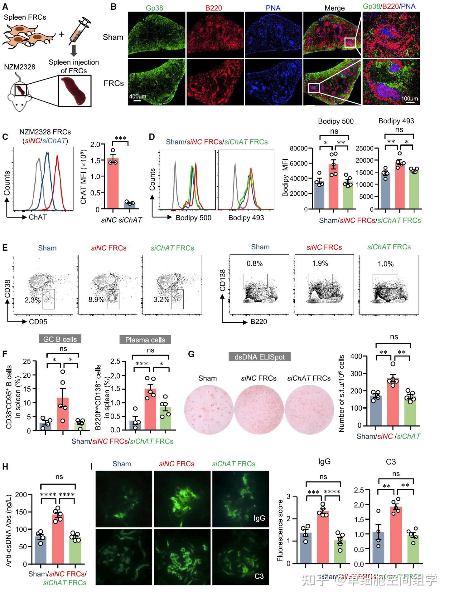 Cell Metabolism|中山大学附属第一医院张辉教授、杨念生教授团队发现脾成纤维网状细胞可促脂质代谢驱动自身反应性B细胞响应 - 知乎