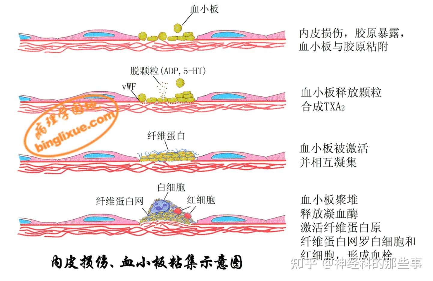 血栓形成的病理过程 - 知乎