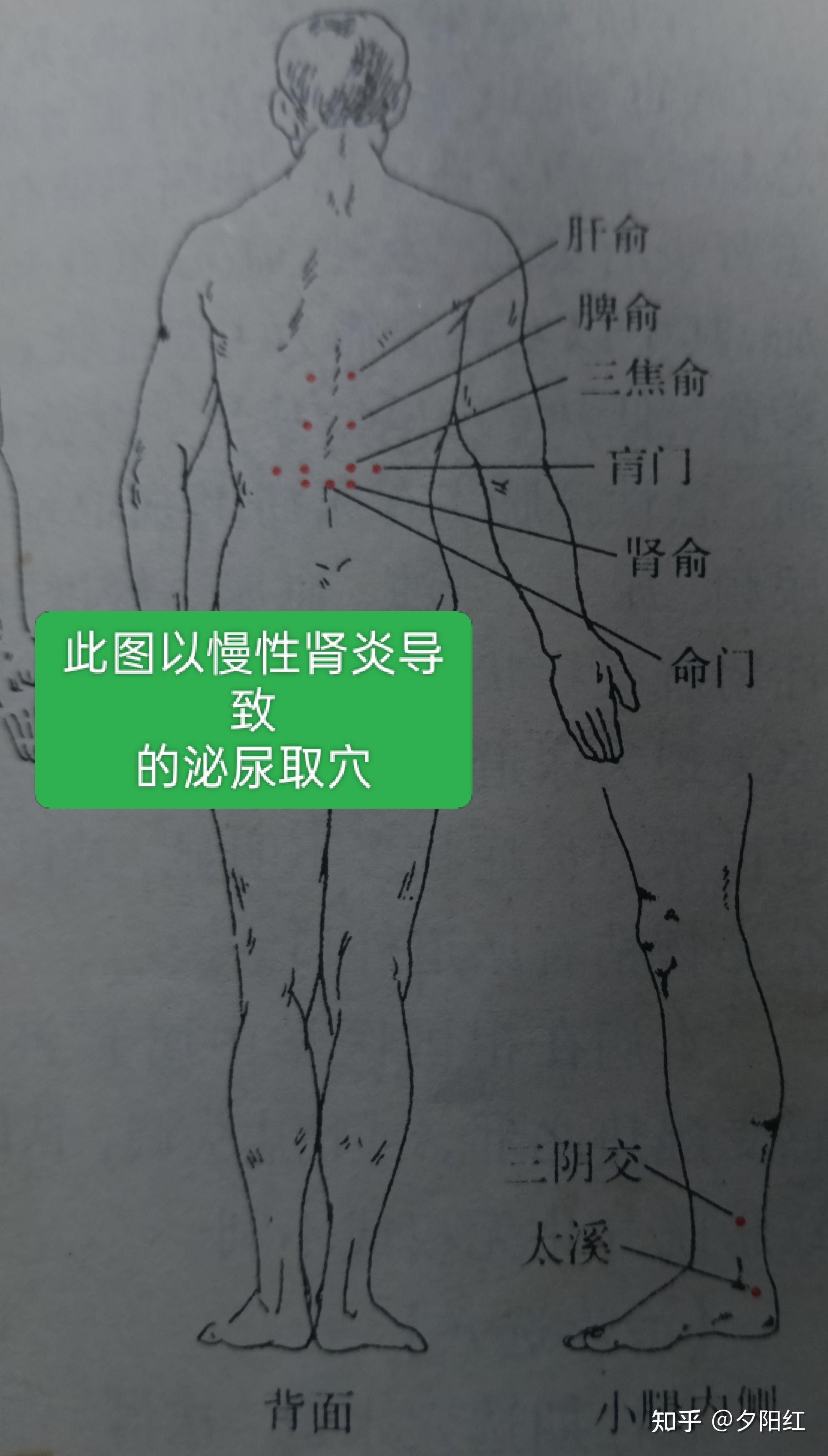 排不出尿按摩哪个穴位? - 知乎