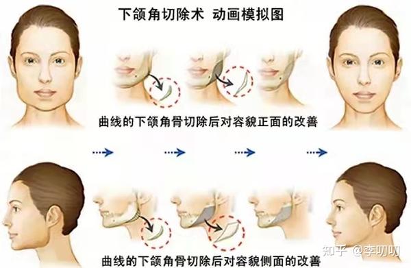 “发腮脸”,你方了吗? - 知乎