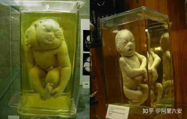 怎么完整的保存一个人的头颅相貌不会变化的那种用福尔马林可以吗?