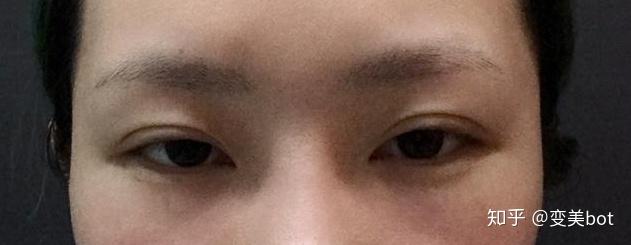 为什么有的人眼睛无神,或者说无神的眼睛有什么特点? - 知乎