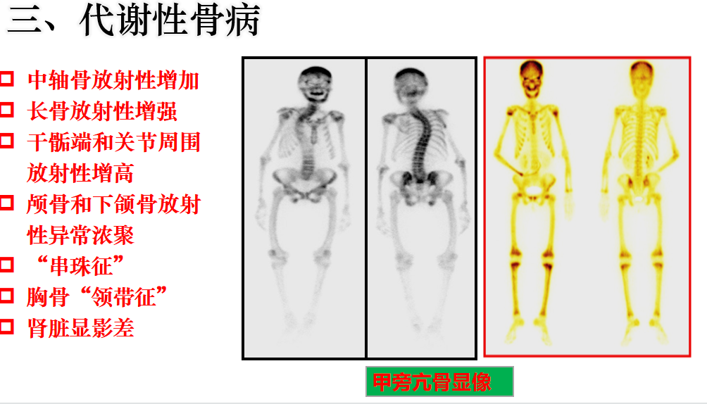 核医学 骨骼系统 PPT课件 - 知乎