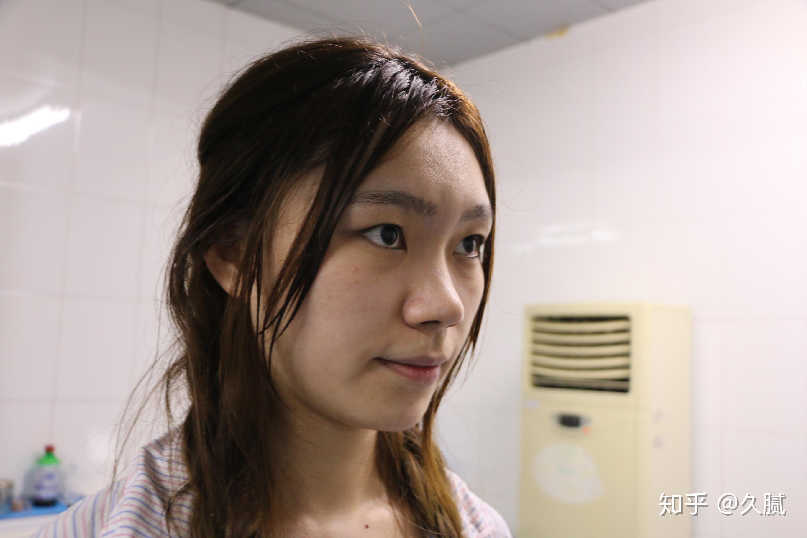 拥有宽鼻翼大鼻头是怎样一种体验? - 知乎