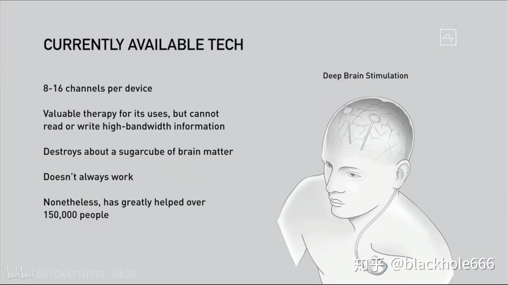 脑机接口马斯克neuralink发布会观感
