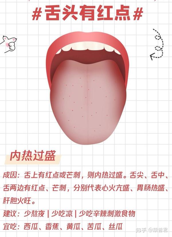 一张图让你简单看懂中医舌诊!