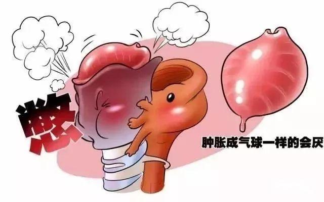 咽喉痛会死人?小心“急性会厌炎”! - 知乎