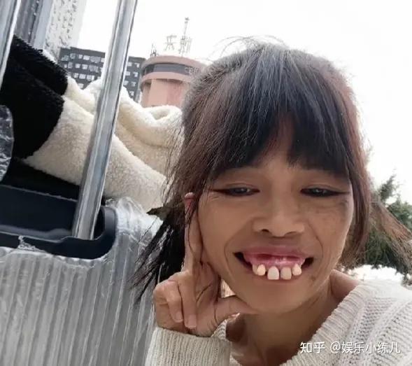 超丑的女照片龅牙的图片