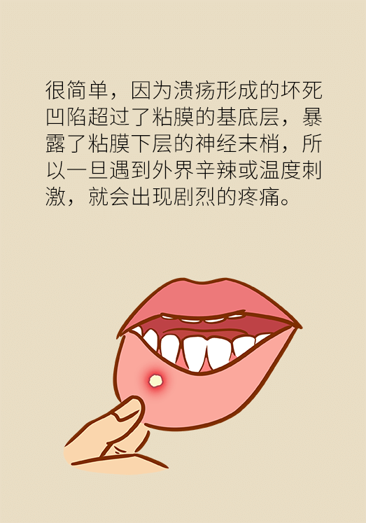 黄晓峰,口腔溃疡,复发性阿弗他溃疡,创伤性溃疡,单纯疱疹感染,反复