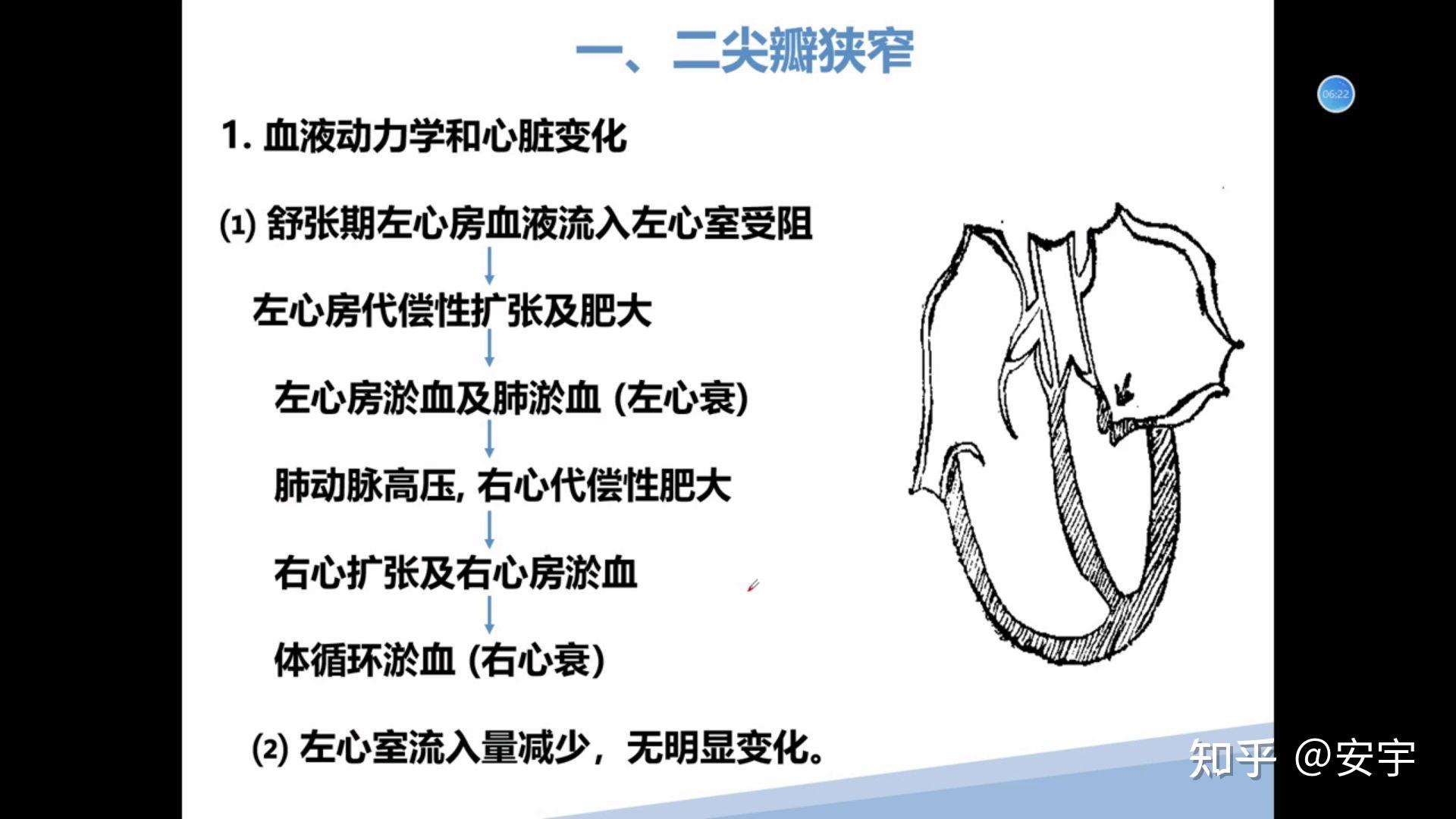 心血管系统疾病 病理 - 知乎