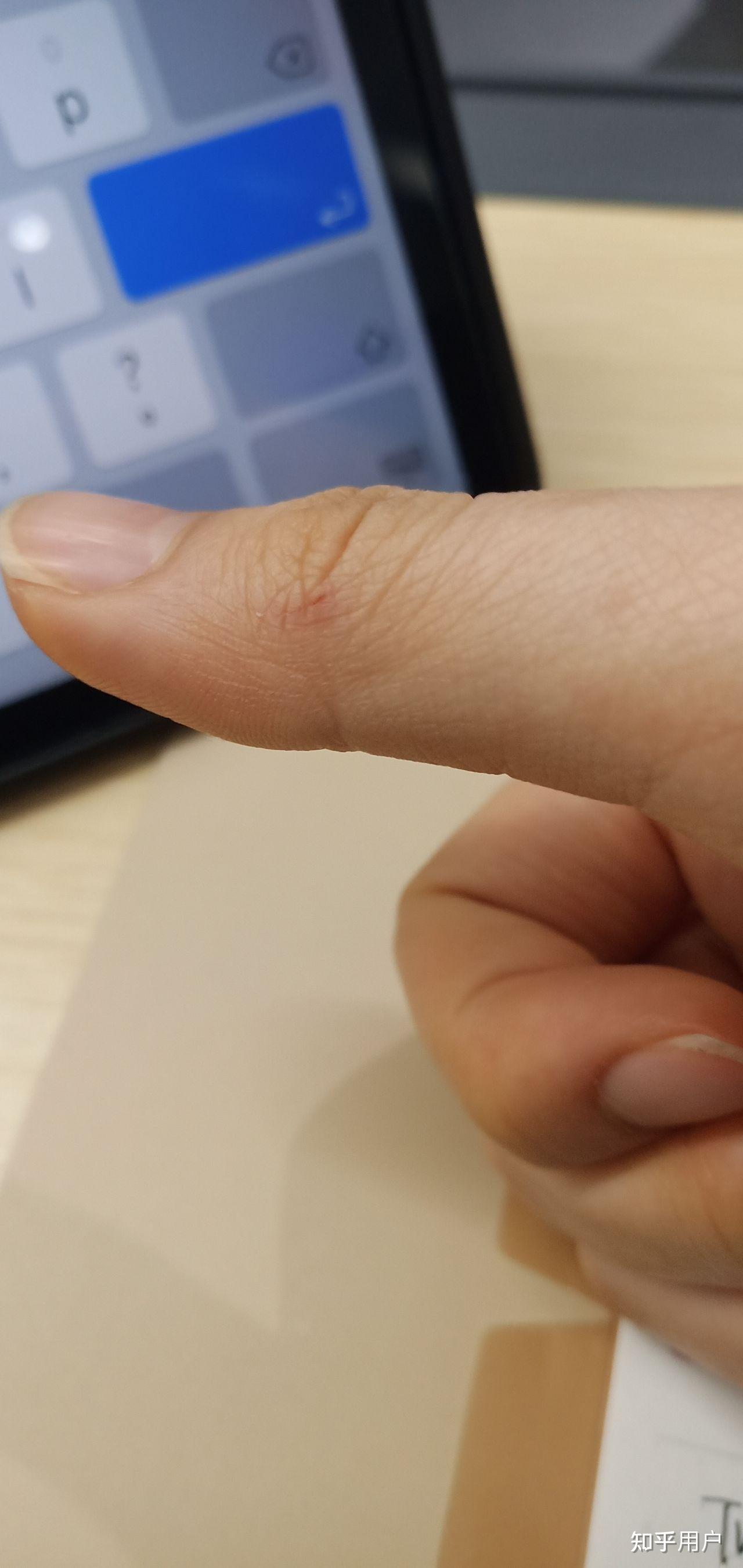 我想问一下兔子咬人有多痛? - 知乎