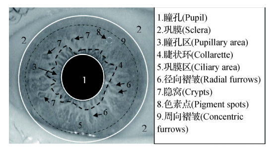 虹膜隐窝位置图片