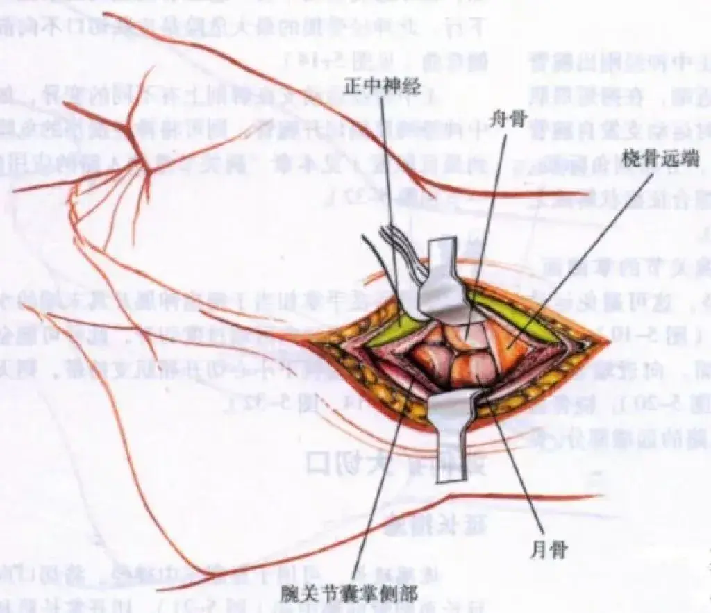 多图详解:常用的31种手术入路 - 知乎