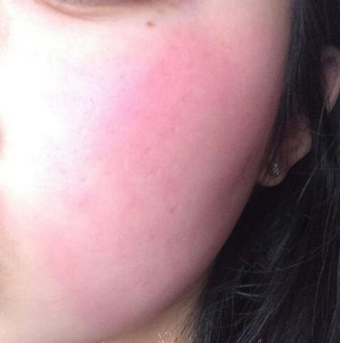 小美医生科普拯救干敏危肌不做沙漠女孩