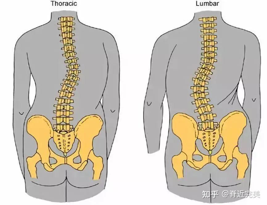 骶髂关节错位症状图片